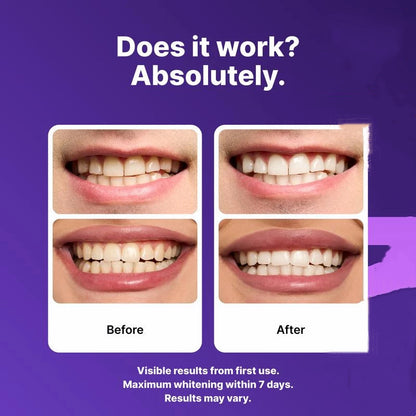 Purple Teeth Whitening Strips 14 Strips