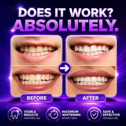 Purple Teeth Whitening Strips 14 Strips